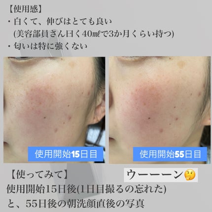 メラノショット W/ONE BY KOSE/美容液を使ったクチコミ(4枚目)