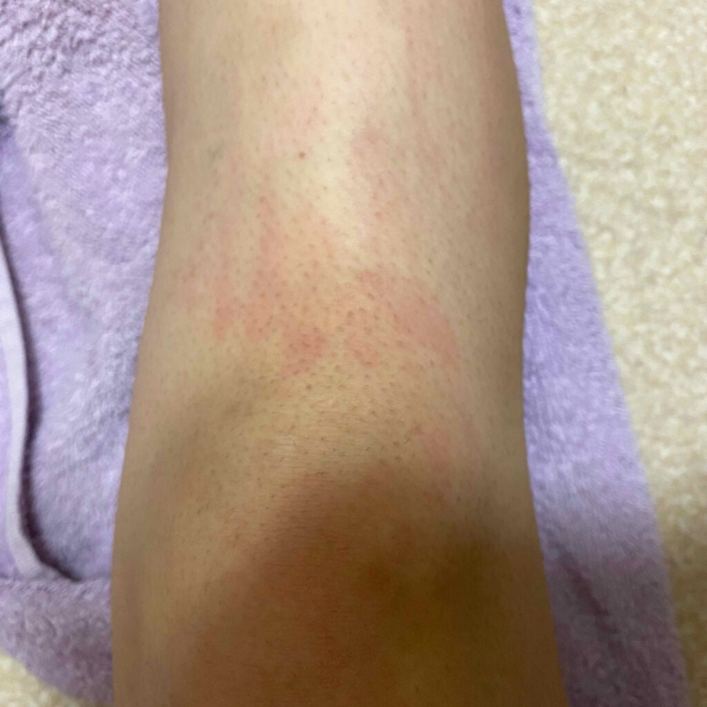 バスタイム除毛クリーム 敏感肌用/Veet/除毛クリームを使ったクチコミ(3枚目)