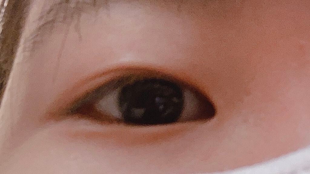 いちご on LIPS 「春からJKなので...二重切開してきました!バリバリの未成年な..」(2枚目)