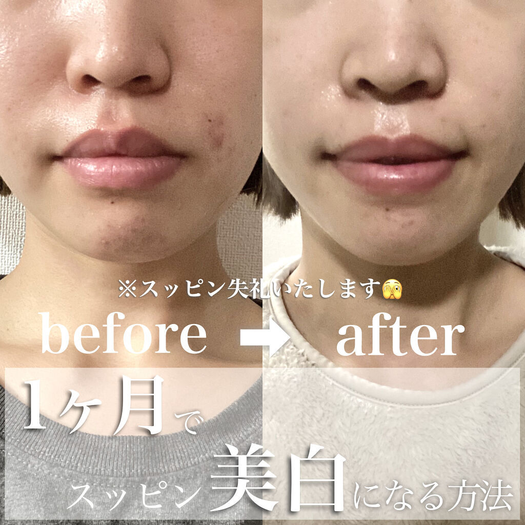 美白乳液 キュレルを使った口コミ 人生で初めて美白効果実感した話 By Konomi 混合肌 代後半 Lips 美白乳液 キュレルを使った口コミ 人生で初めて美白効果実感した話 By Konomi 混合肌 代後半 Lips