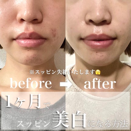 シミ・ソバカス予防ケア 乳液/キュレル/乳液を使ったクチコミ(1枚目)