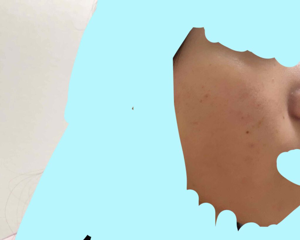 ヒルメナイド油性クリーム(医薬品)/matsukiyo/その他を使ったクチコミ(1枚目)