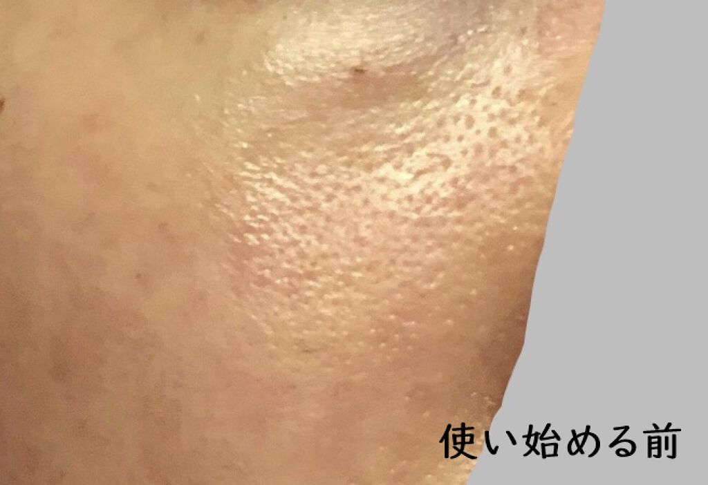 クレンジングクリーム/APEX/クレンジングクリームを使ったクチコミ（2枚目）