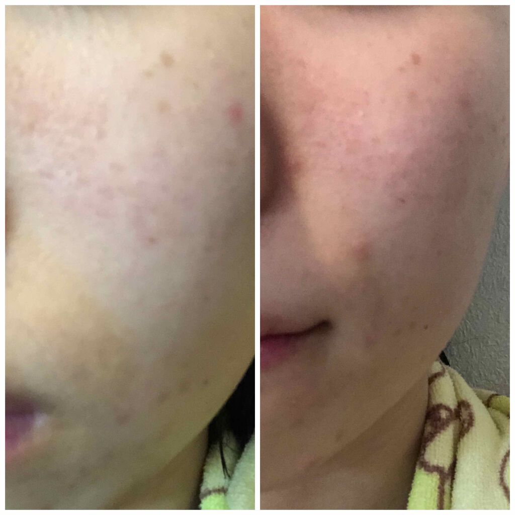 EclatCharme(エクラシャルム)/FABIUS/オールインワン化粧品を使ったクチコミ(4枚目)