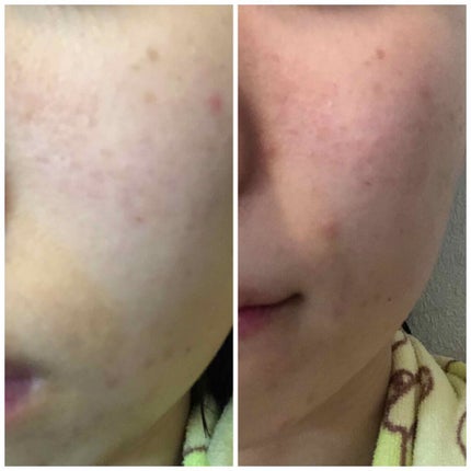 EclatCharme(エクラシャルム)/FABIUS/オールインワン化粧品を使ったクチコミ(4枚目)