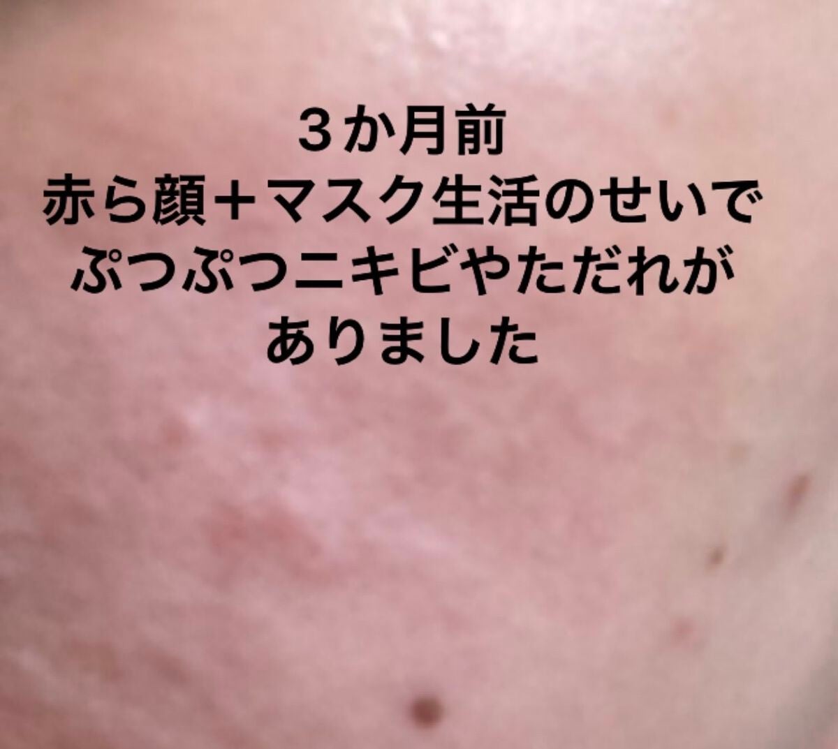 CICA クリーム/VT/フェイスクリームを使ったクチコミ(3枚目)