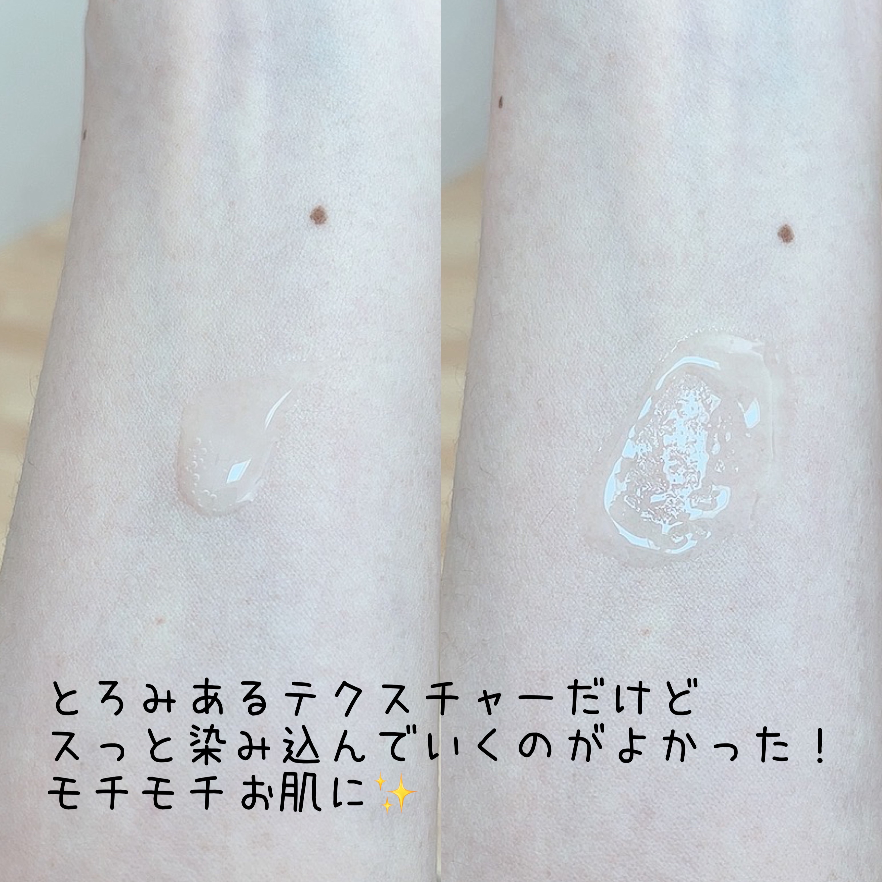 カーミングトナー　　　/ピュレアジー/化粧水を使ったクチコミ（3枚目）