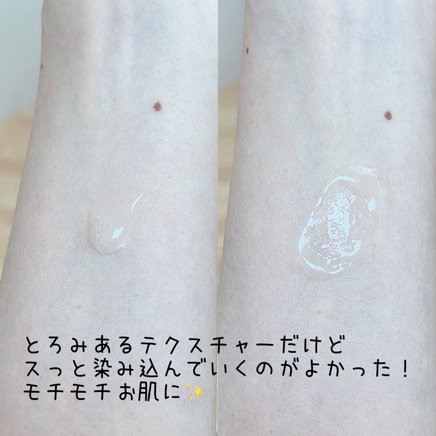 カーミングトナー /ピュレアジー/化粧水を使ったクチコミ(3枚目)