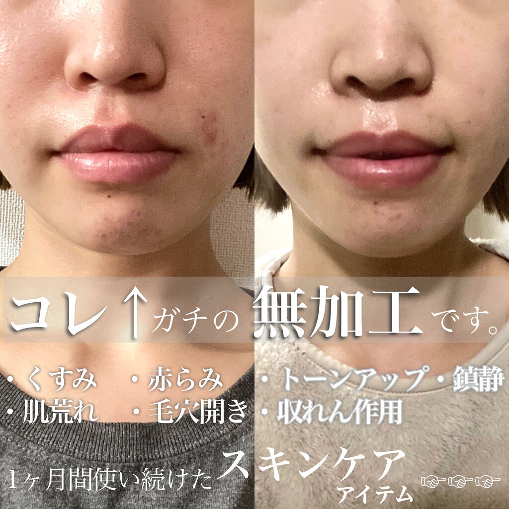 シミ・ソバカス予防ケア　乳液/キュレル/乳液を使ったクチコミ（2枚目）