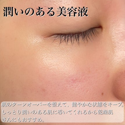 3GF リペアエッセンス/cos:mura/美容液を使ったクチコミ(6枚目)