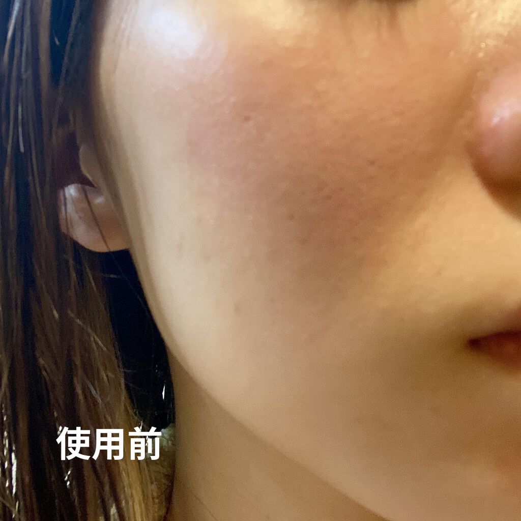 ドクタージャルト シカペア クリーム （第2世代）/Dr.Jart＋/フェイスクリームを使ったクチコミ（2枚目）