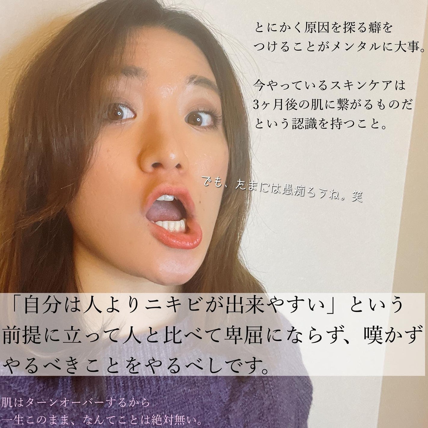 おゆみ|ニキビ・ニキビ跡ケア on LIPS 「【ニキビ歴15年の私が語るニキビの哲学】ニキビとの..」(6枚目)