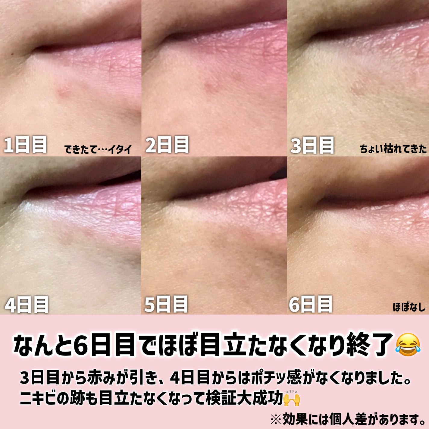 AZケア マスク/VT/シートマスク・パックを使ったクチコミ(4枚目)