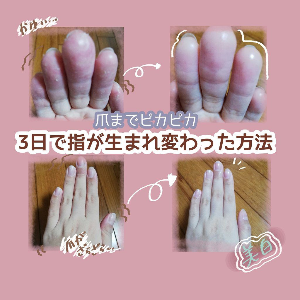 薬用ホワイトニング ハンドクリーム ディープモイスチュア/コエンリッチQ10/ハンドクリームを使ったクチコミ（1枚目）