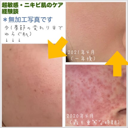 濃密あわ洗顔せっけん/Mマークシリーズ/洗顔石鹸を使ったクチコミ(2枚目)