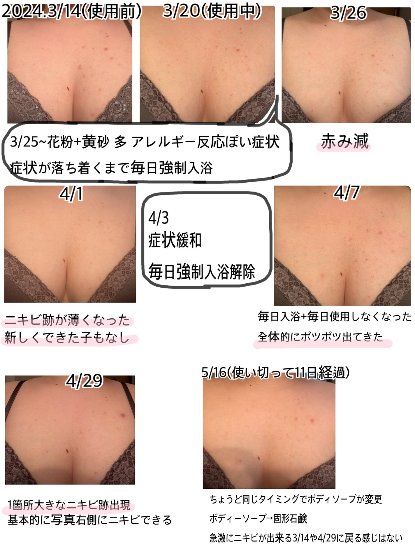 レッドブレミッシュスージングボディーミスト/Dr.G/ボディローションを使ったクチコミ(4枚目)