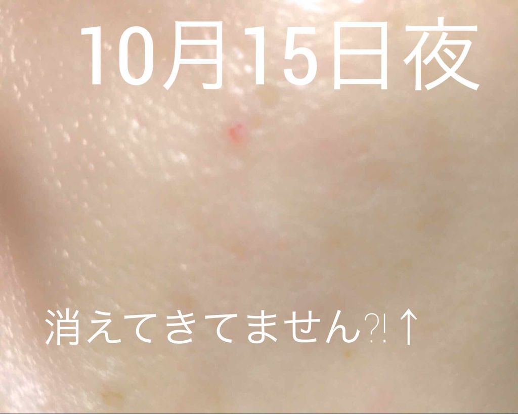 スムースローション/skinvill/化粧水を使ったクチコミ(3枚目)