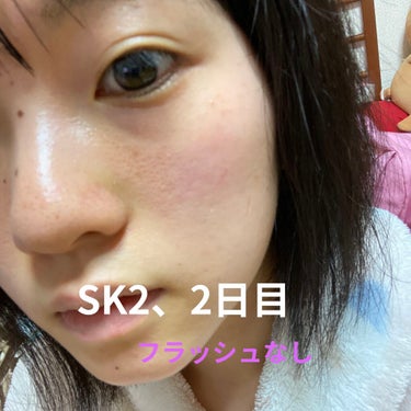 フェイシャル トリートメント エッセンス/SK-II/化粧水を使ったクチコミ（4枚目）