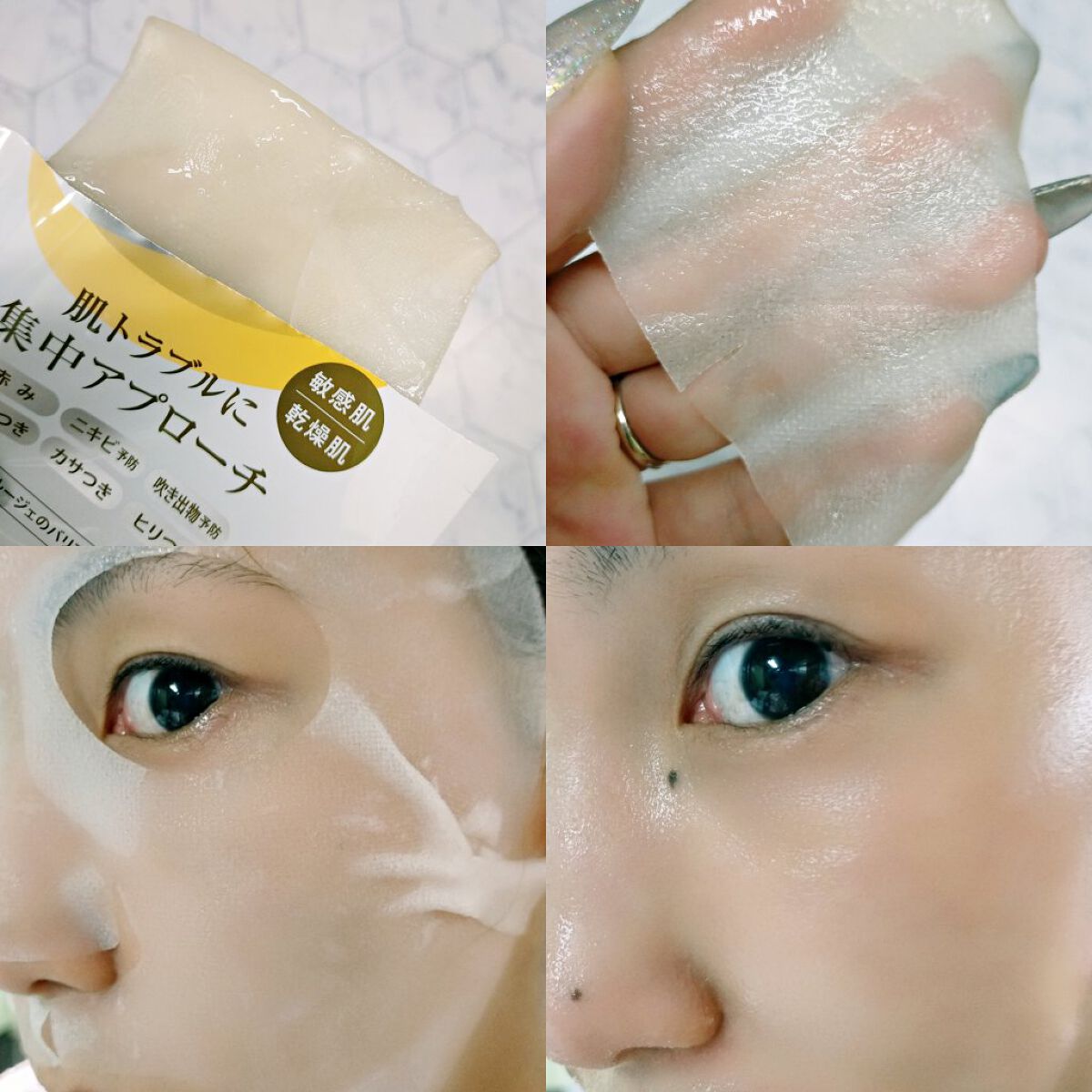 スキントラブルケア マスク/アルージェ/シートマスク・パックを使ったクチコミ（2枚目）