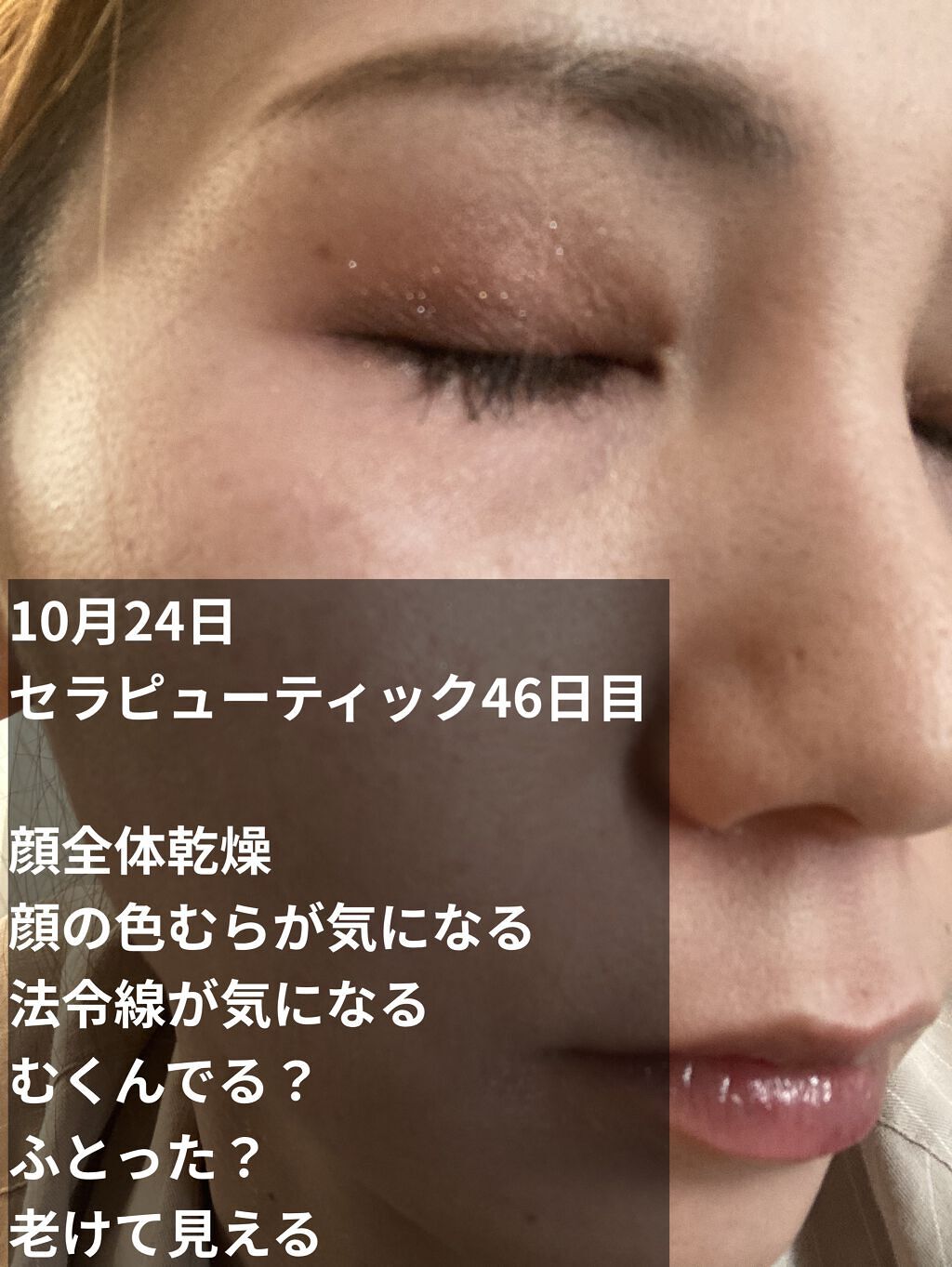 ミラミックス/ZO Skin Health/フェイスクリームを使ったクチコミ（2枚目）