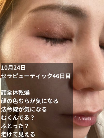 ミラミン/ZO Skin Health/フェイスクリームを使ったクチコミ(2枚目)