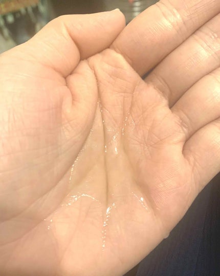 バイオイル/バイオイル/フェイスオイルを使ったクチコミ(2枚目)