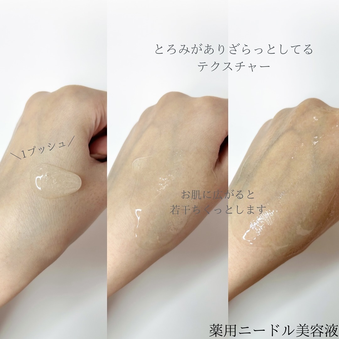 京薬粧 薬用ニードルクリーム/京薬粧/フェイスクリームを使ったクチコミ（2枚目）