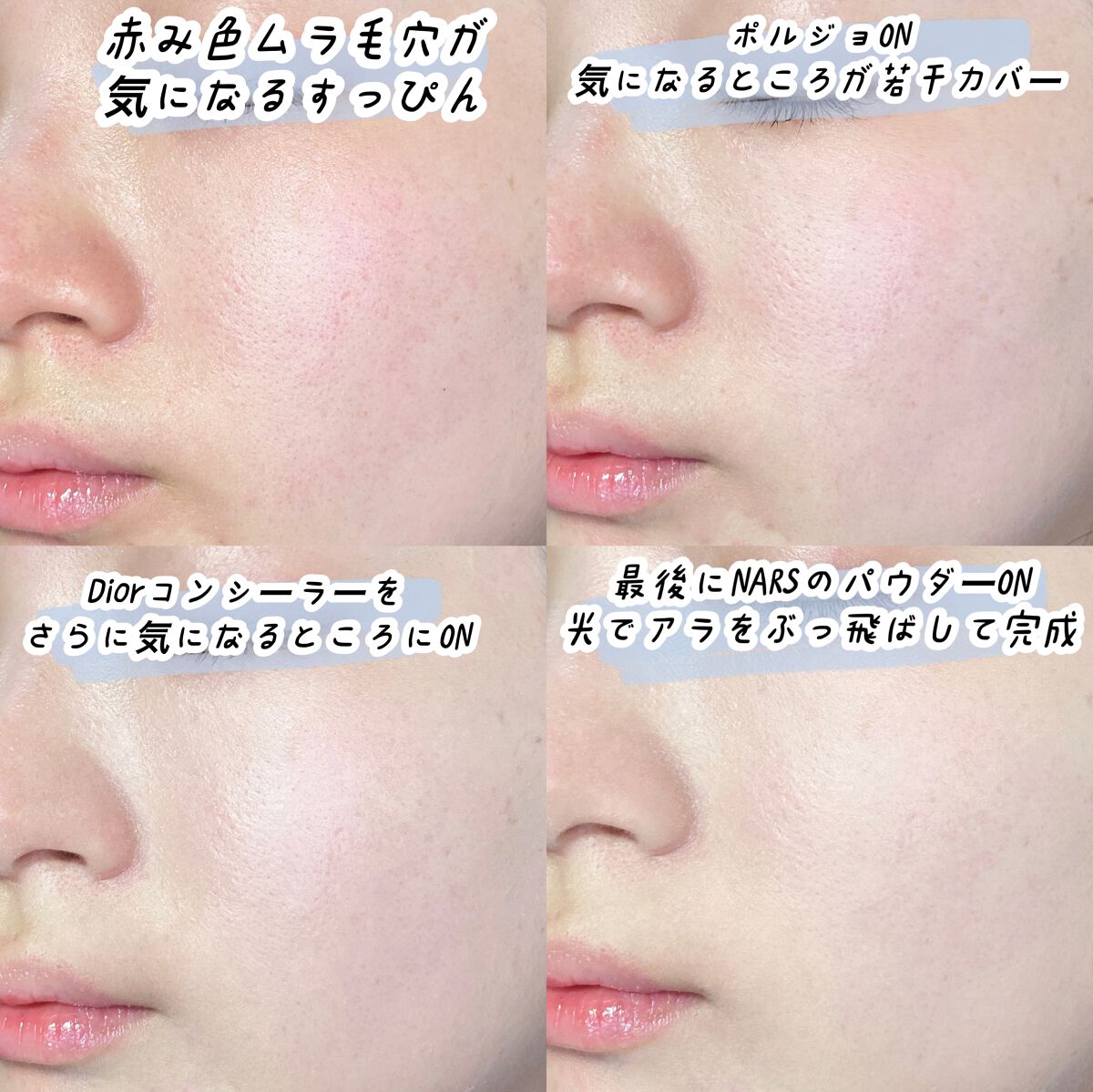 【旧】ディオールスキン フォーエヴァー スキン コレクト コンシーラー/Dior/リキッドコンシーラーを使ったクチコミ(5枚目)