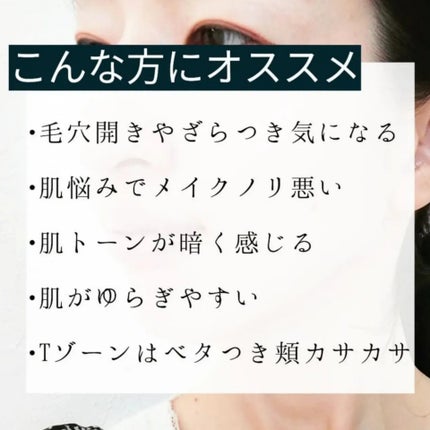 フェイシャルトリートメントセラムGA/KISO/美容液を使ったクチコミ(2枚目)