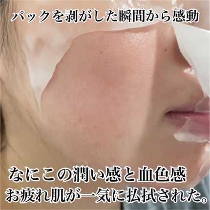 炭酸パック プルリ/ウツクシア/洗い流すパック・マスクを使ったクチコミ(4枚目)
