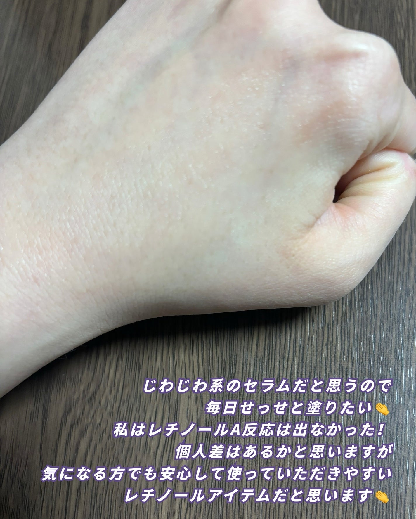 レチノールインテンスリアクティベーションセラム/SOME BY MI/美容液を使ったクチコミ(5枚目)