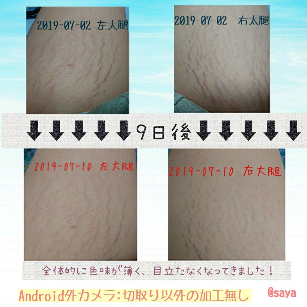 ニベアクリーム/ニベア/ボディクリームを使ったクチコミ(2枚目)