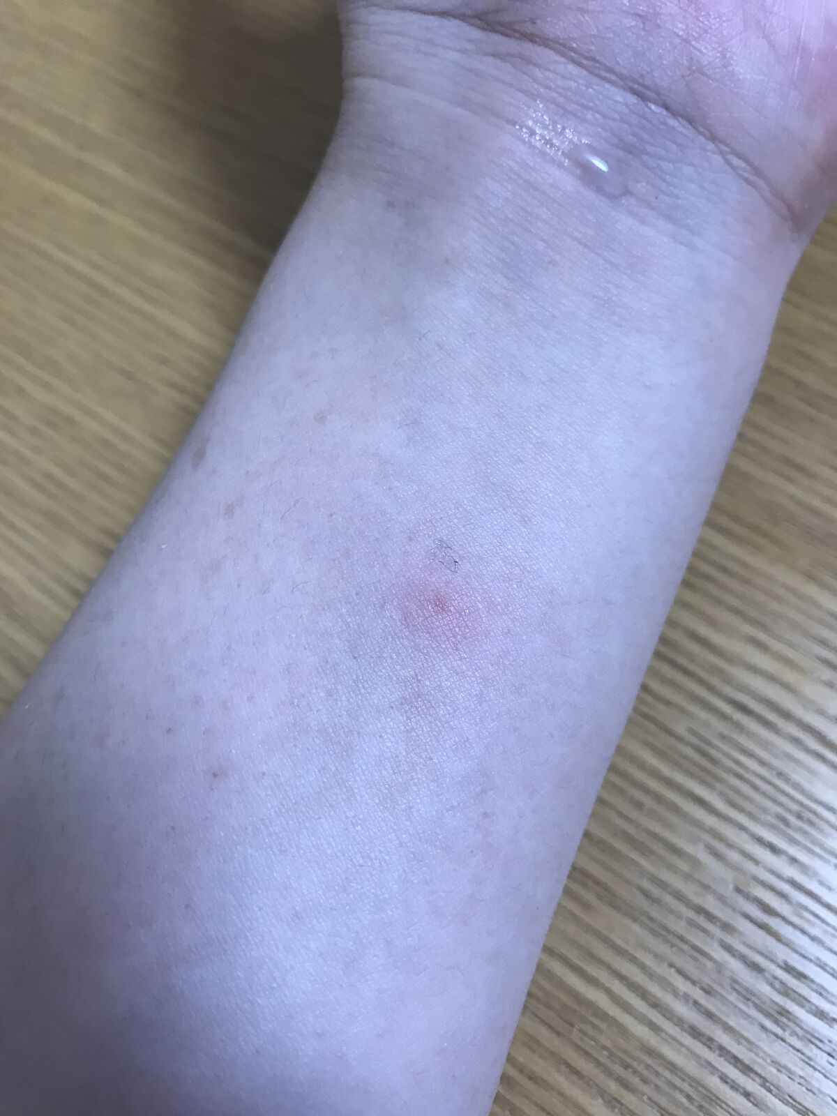 ポケムヒ(医薬品)/池田模範堂/その他を使ったクチコミ（3枚目）