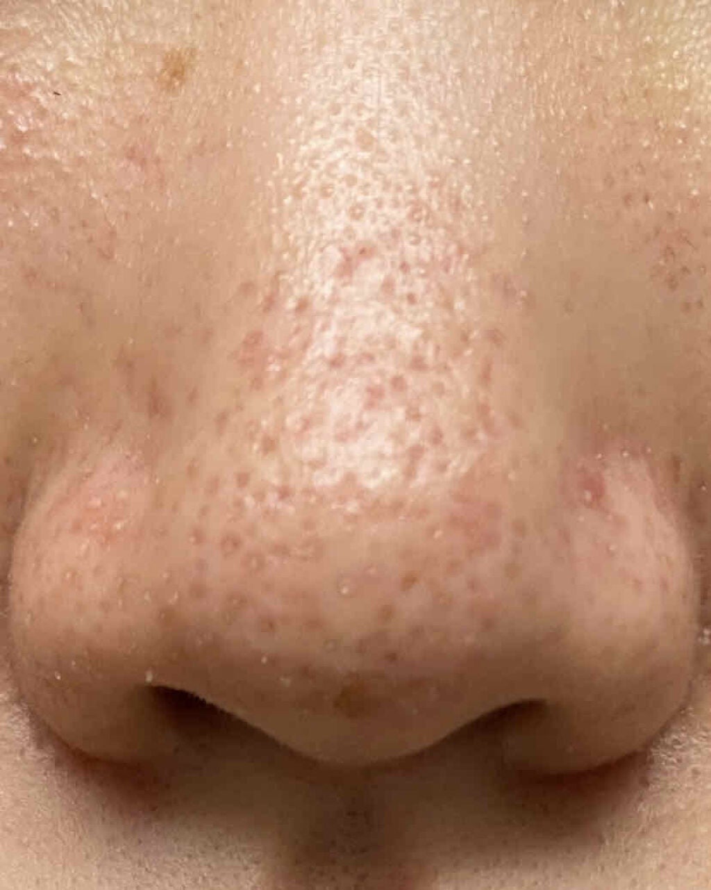 濃密うるみ肌 オールインワンリッチジェル/DHC/オールインワン化粧品を使ったクチコミ(1枚目)