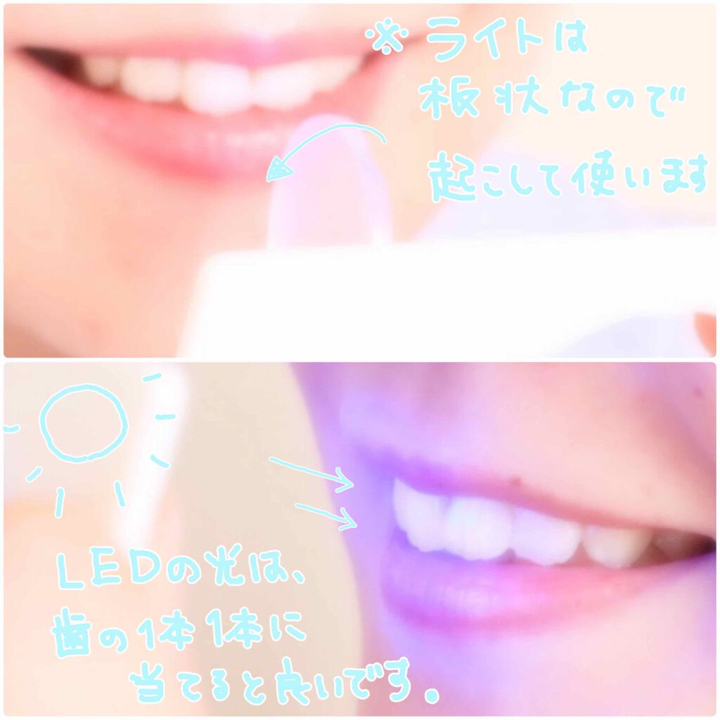 HITEETH ALL IN ONE MOUTH GEL SHINING LEDライト付き/R&/その他オーラルケアを使ったクチコミ（2枚目）