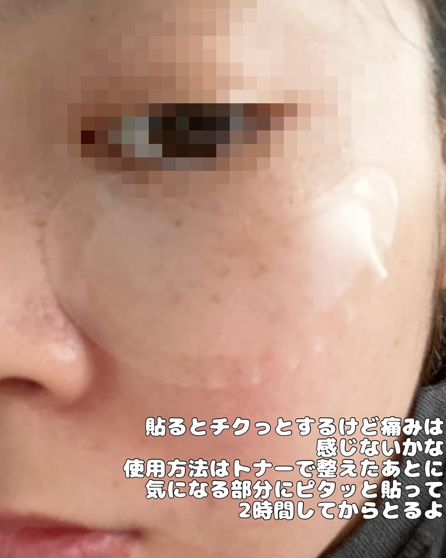 ちゃぴ on LIPS 「テラロジックRetinAポアタイトニングラッピングマスク&Re..」(5枚目)