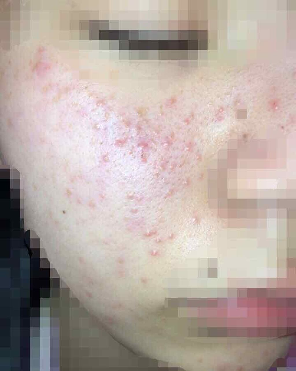 ハトムギ化粧水(ナチュリエ スキンコンディショナー R )/ナチュリエ/化粧水を使ったクチコミ(2枚目)