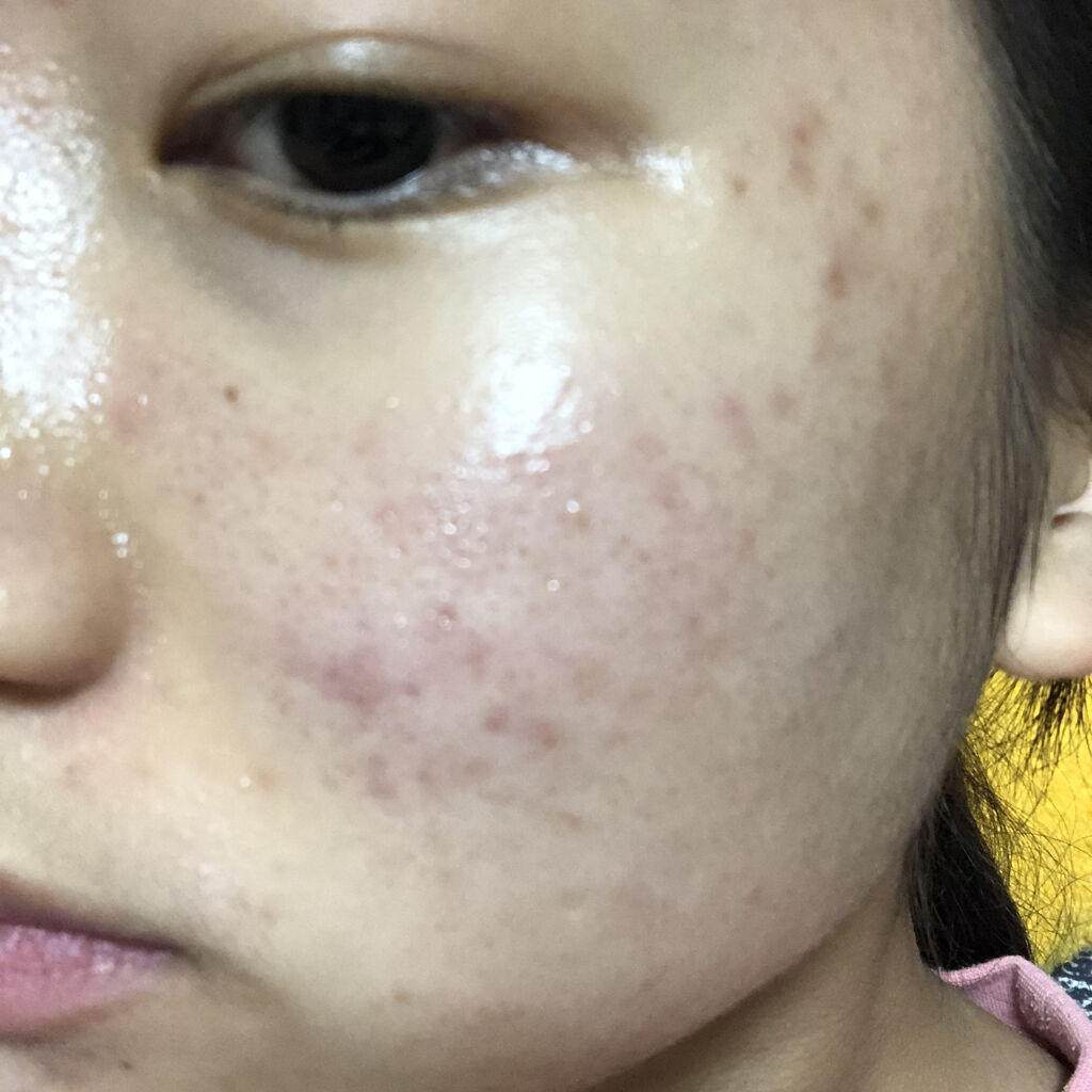 を使ったクチコミ（1枚目）