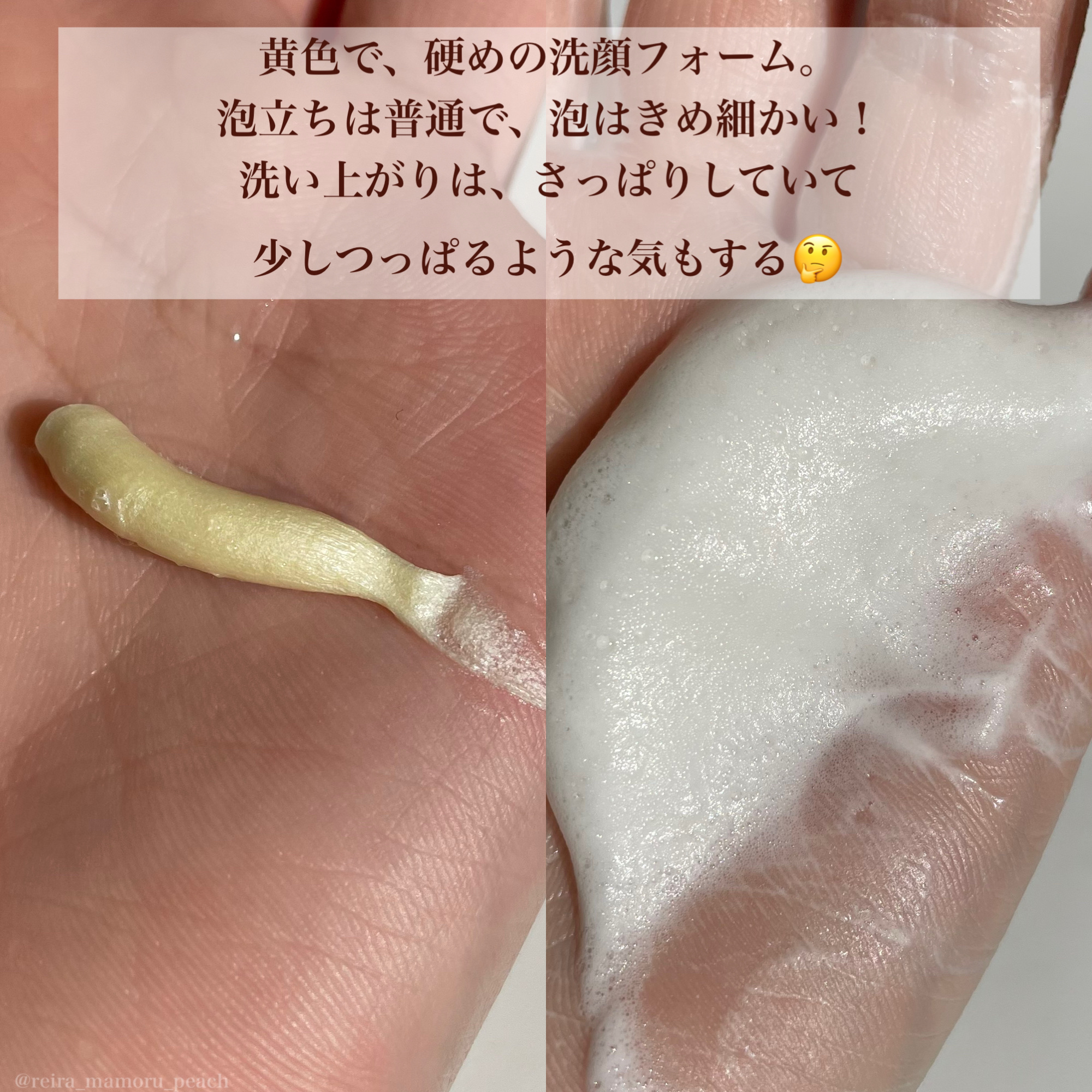 シカバイタル フォームクレンザー/VT/洗顔フォームを使ったクチコミ（2枚目）