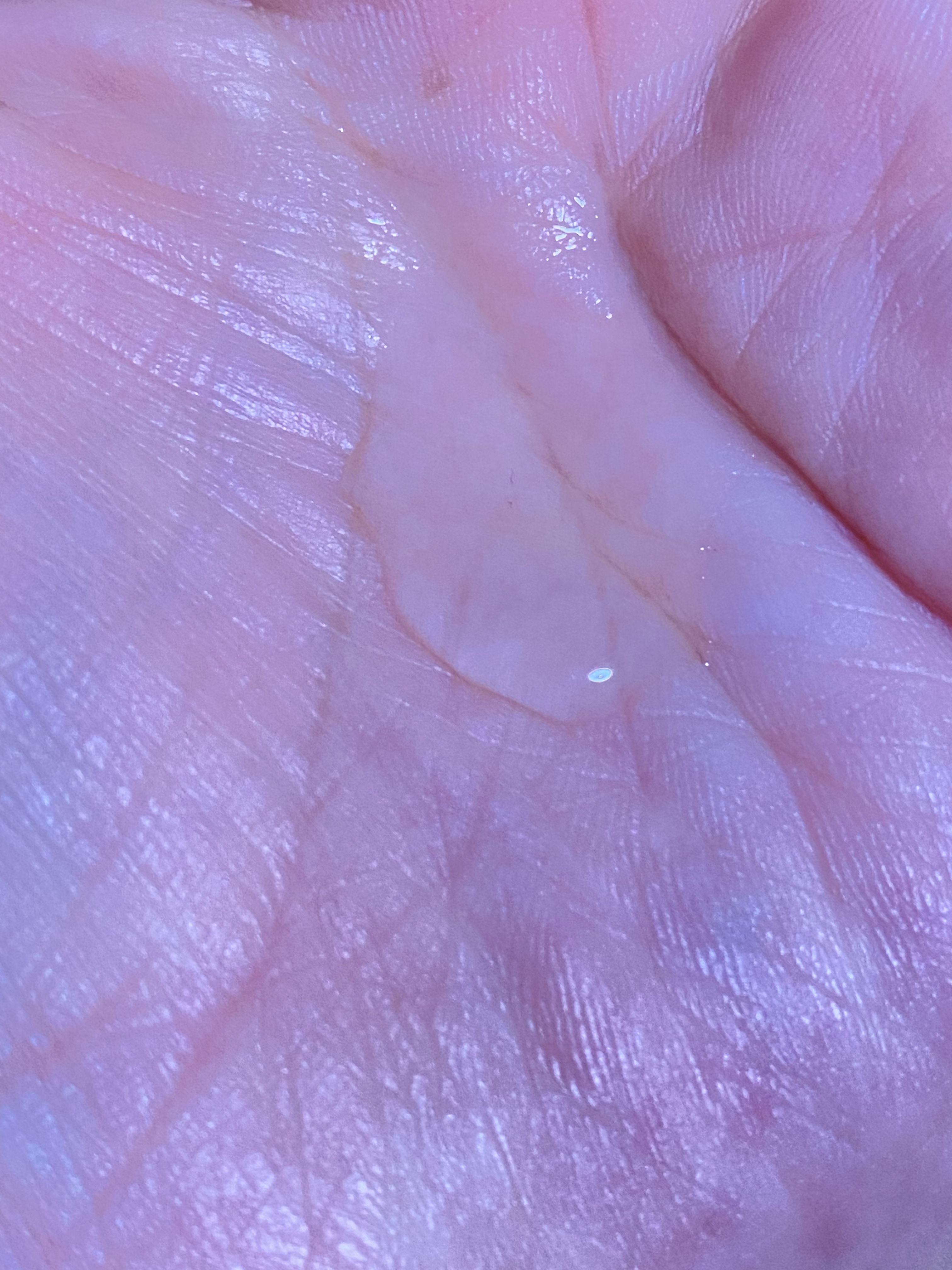 パイナップル豆乳ローションプレミアム/鈴木ハーブ研究所/ボディローションを使ったクチコミ（2枚目）