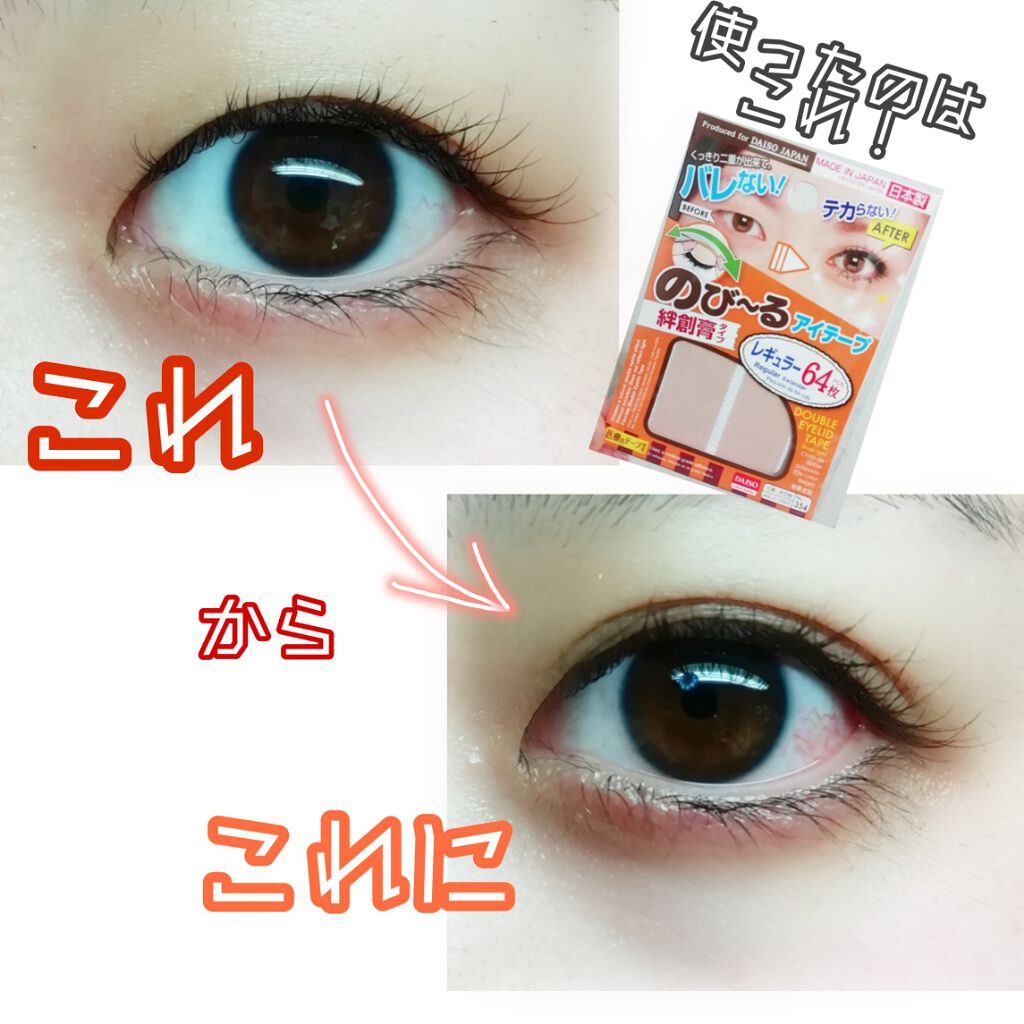 のびーるアイテープ(絆創膏タイプ、レギュラー)/DAISO/二重まぶた用アイテムを使ったクチコミ(1枚目)