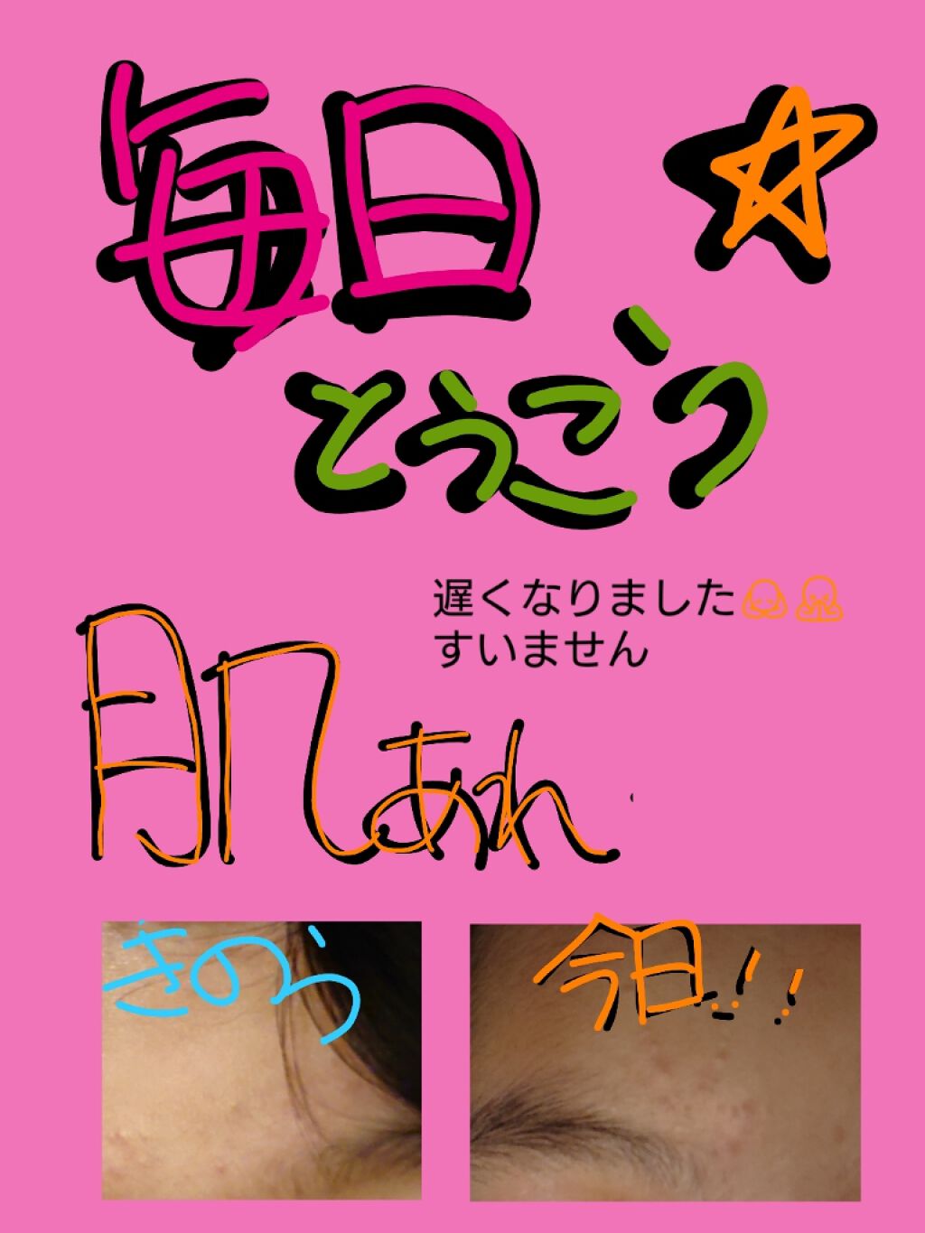 官ツバメの巣マスク（4枚入）/我的美麗日記/シートマスク・パックを使ったクチコミ（1枚目）