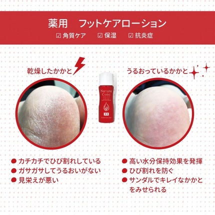 ネイチャーコンク薬用フットケアローション/ネイチャーコンク/レッグ・フットケアを使ったクチコミ(2枚目)