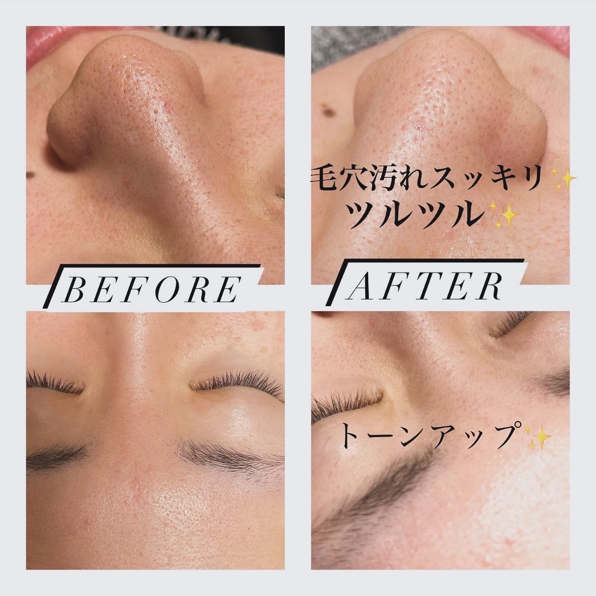 エスト AC ピュリファイ マッサージウォッシュ/est/泡洗顔を使ったクチコミ(4枚目)