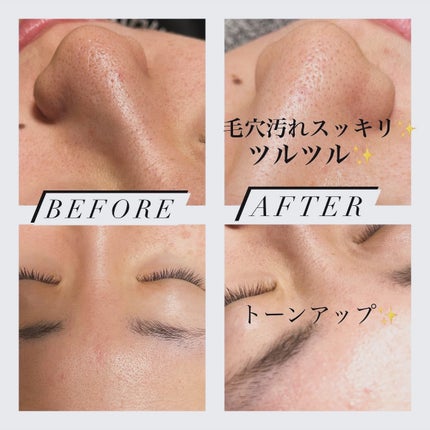 エスト AC ピュリファイ マッサージウォッシュ/est/泡洗顔を使ったクチコミ(4枚目)