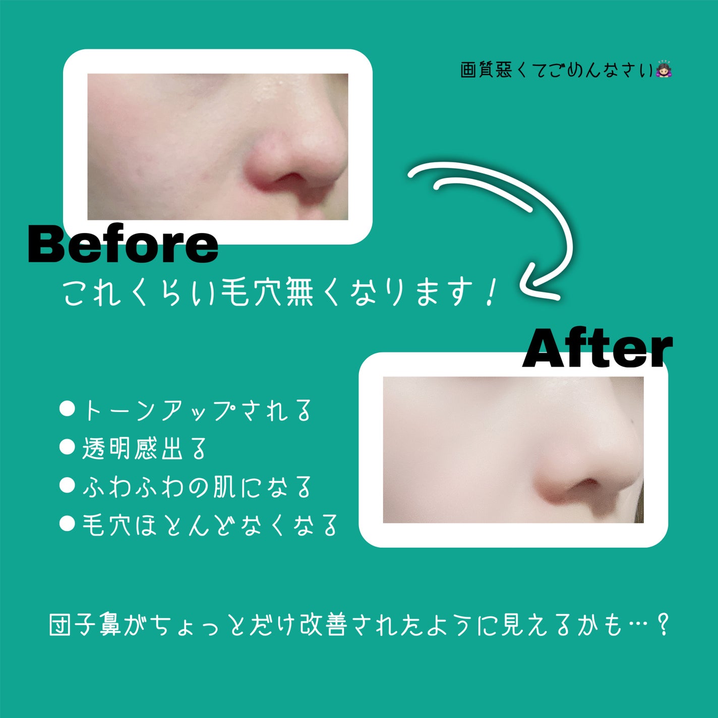 薬用しみ対策 美白化粧水/メラノCC/化粧水を使ったクチコミ(2枚目)