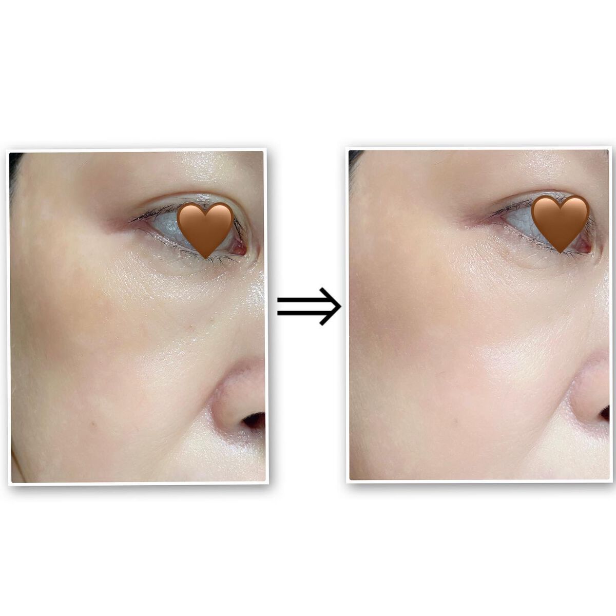 ダブルキュアブレミッシュバーム/BQCELL/BBクリームを使ったクチコミ(7枚目)