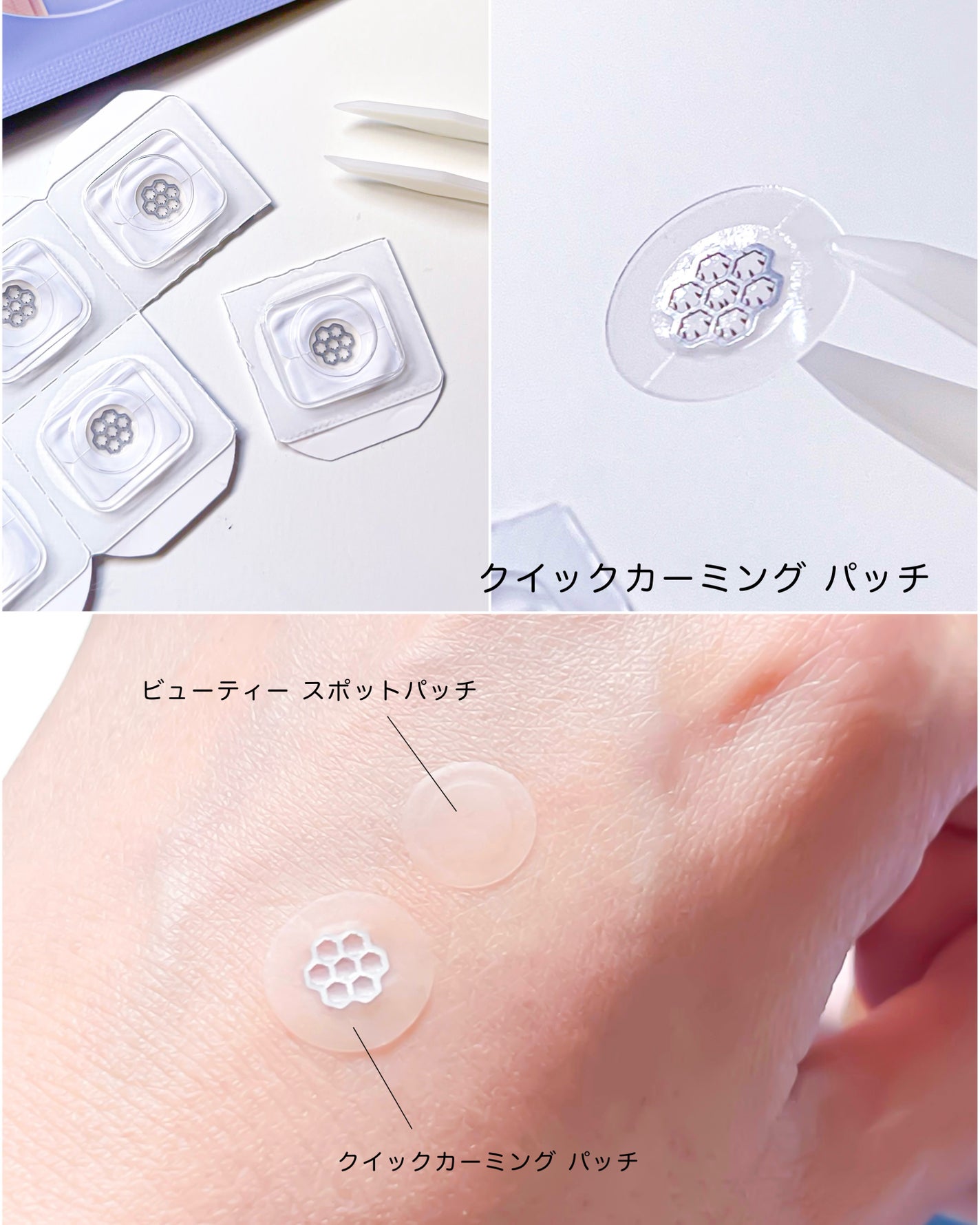 ビューティー スポットパッチ/イージーダムビューティー/にきびパッチを使ったクチコミ(6枚目)