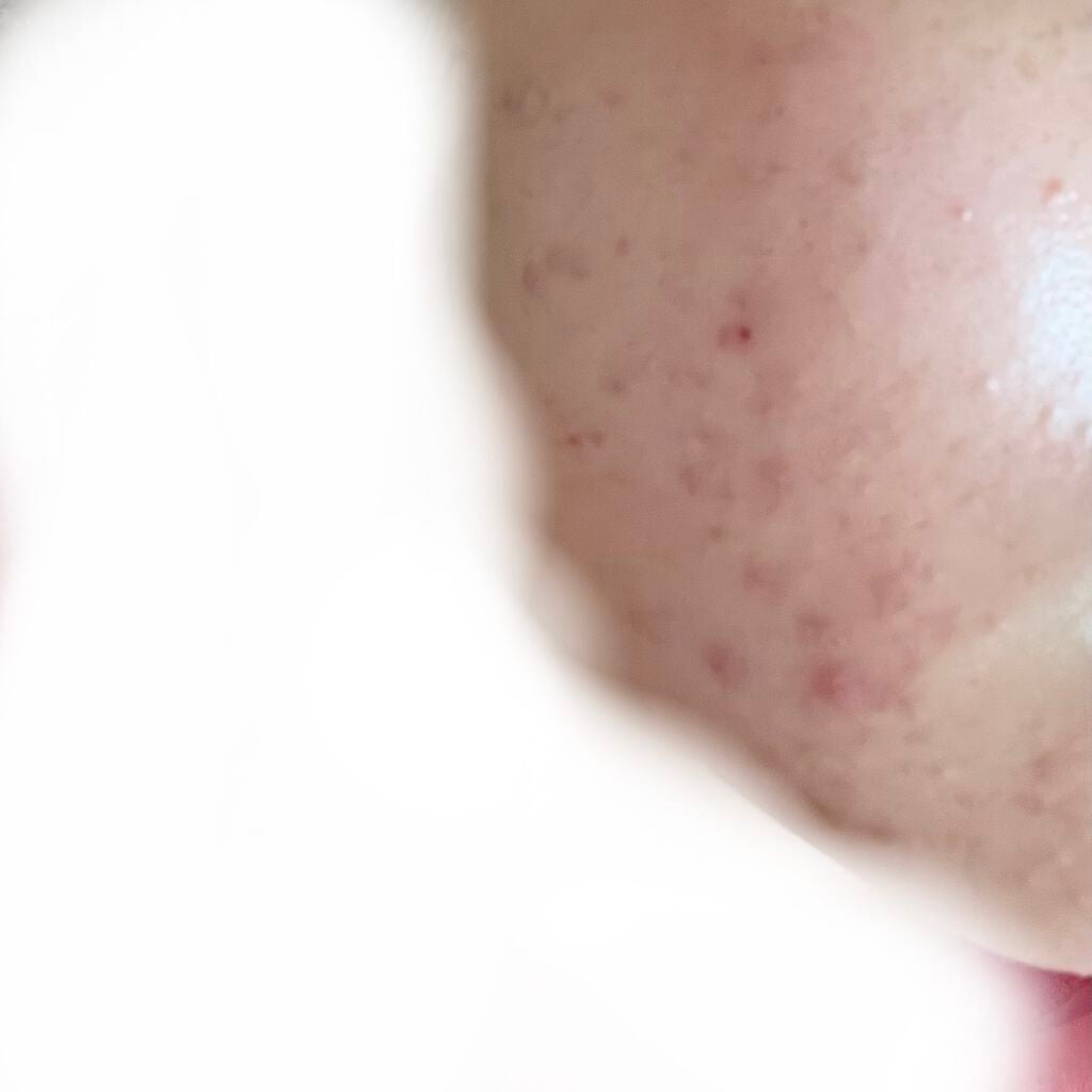 アルビオン 薬用スキンコンディショナー エッセンシャル/ALBION/化粧水を使ったクチコミ(1枚目)