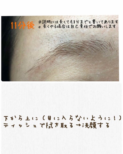 脱色クリーム スピーディー/エピラット/ムダ毛ケアを使ったクチコミ(6枚目)